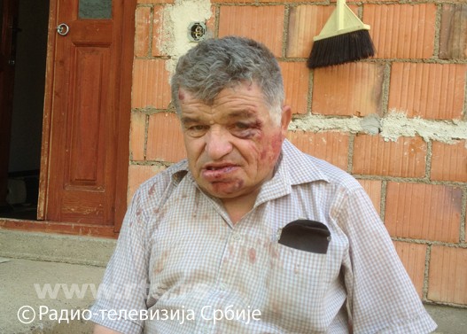 Нападнут зато што је Србин