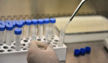 Из лабараторије у Тексасу нестала епрувета са смртоносним вирусом