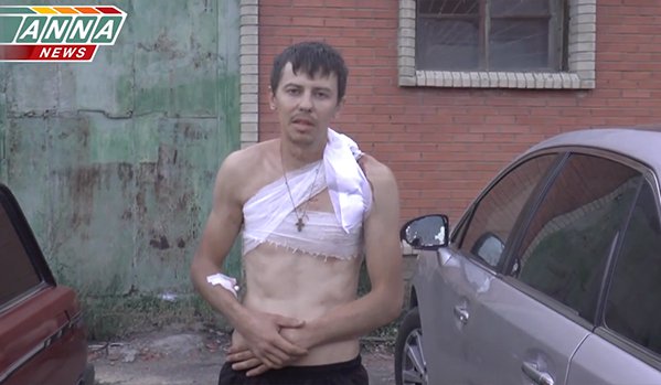 У нападу на Луганск рањен новинар Anna-news и возач