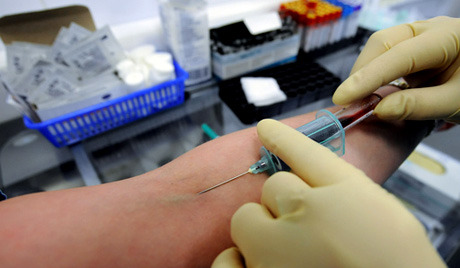 Analiza krvi će zameniti biopsiju i operacije